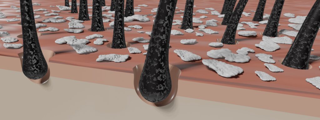 Hair follicles and dandruff under microscope - 3D illustration