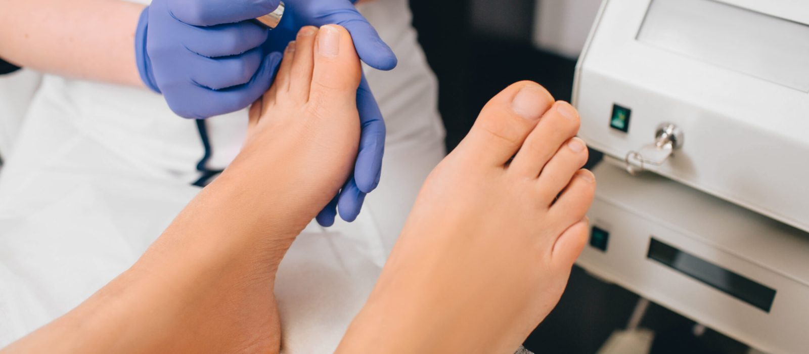 Patient receiving laser treatment on toenail, close-up. Fungal infection on the toenails. Onychomycosis treatment at clinic with medical laser
