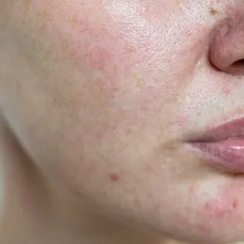 rs=w_600,h_300,cg_true (65)